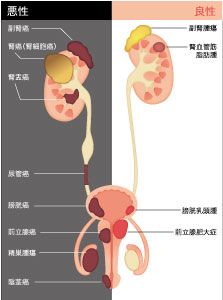 その他の腹腔鏡手術画像