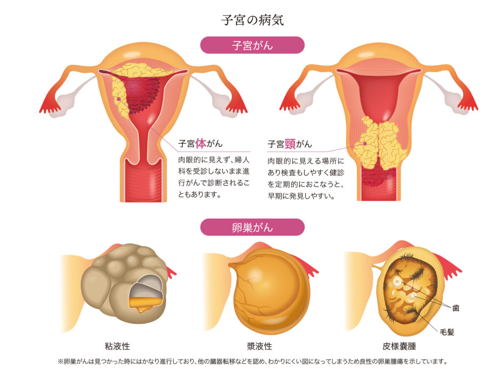 子宮 